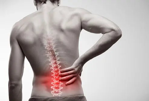 Lower Back Pain: Causes, Relief, and When to See a Physiotherapist